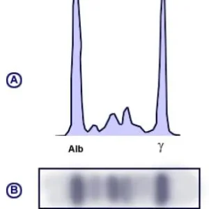 PROTEIN ELECTROPHOROSIS SERUM