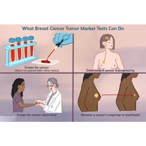 CA 27.29; BREAST CANCER MARKER