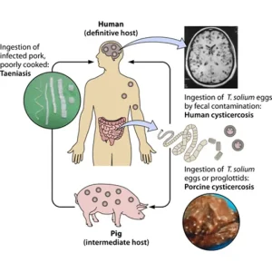 CYSTICERCUS(TAENIA SOLIUM), IGG