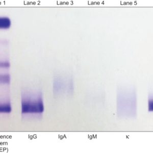 IMMUNOFIXATION ELECTROPHORESIS (IFE,SERUM)