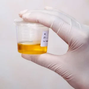 CORTISOL, FREE, 24-HOUR URINE