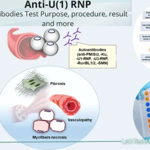U1RNP ANTIBODIES