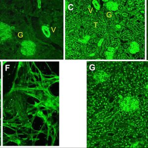 SMOOTH MUSCLE ANTIBODY, IFA