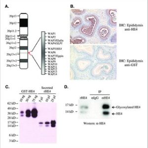 HE4; HUMAN EPIDIDYMIS PROTEIN 4