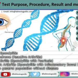 HLAB-27 FLOW CYTOMETRY