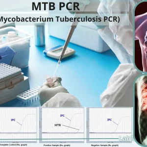 MYCOBACT TB PCR(SPUTUM)