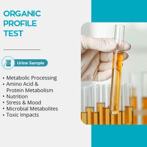 ORGANIC ACIDS, QUANTITATIVE,