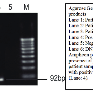 HERPES SIMPLEX VIRUS (HSV) TYPE 1 & 2, PCR, QUALITATIVE