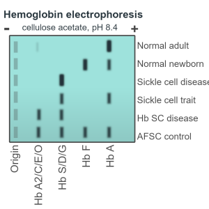 HEMOGLOBIN,HPLC/ELECTROPHORESIS