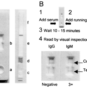 BRUCELLA IGG ANTIBODY, SERUM