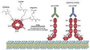 PHOSPHOLIPID ANTIBODIES PANEL, IGG & IGM