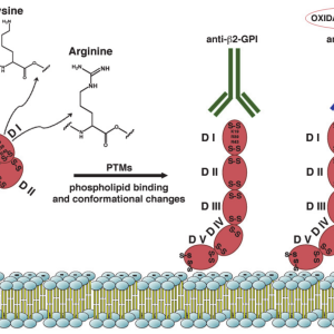 PHOSPHOLIPID ANTIBODIES PANEL, IGG & IGM