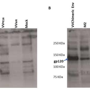HIV 1 & 2 ANTIBODIES, WESTERN BLOT