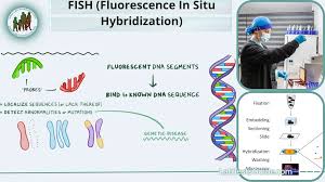 FISH - MDS PANEL - CHROMOSOMES 5Q, 7Q, 8Q & 20Q.