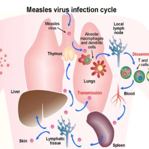 MEASLES (RUBEOLA) ANTIBODY, IGG