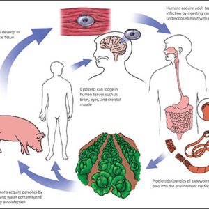 CYSTICERCOSIS ( TAENIA SOLIUM), IGG