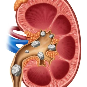 STONE ANALYSIS WITH PICTURE